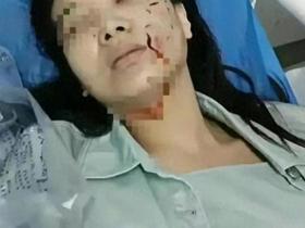 江苏松狮犬咬人事件:不是谁受伤就有理,成年人要有防范风险意识