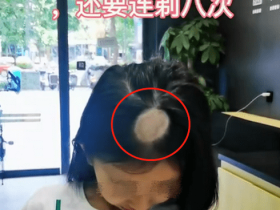 买猫来不到10天,女儿的头顶秃了,妈妈傻眼:想哭